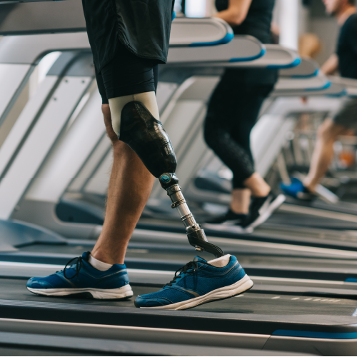 A person with a prosthetic leg running on the treadmill